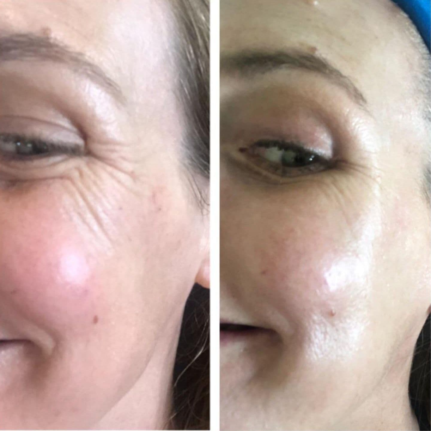 Αποτέλεσμα 4