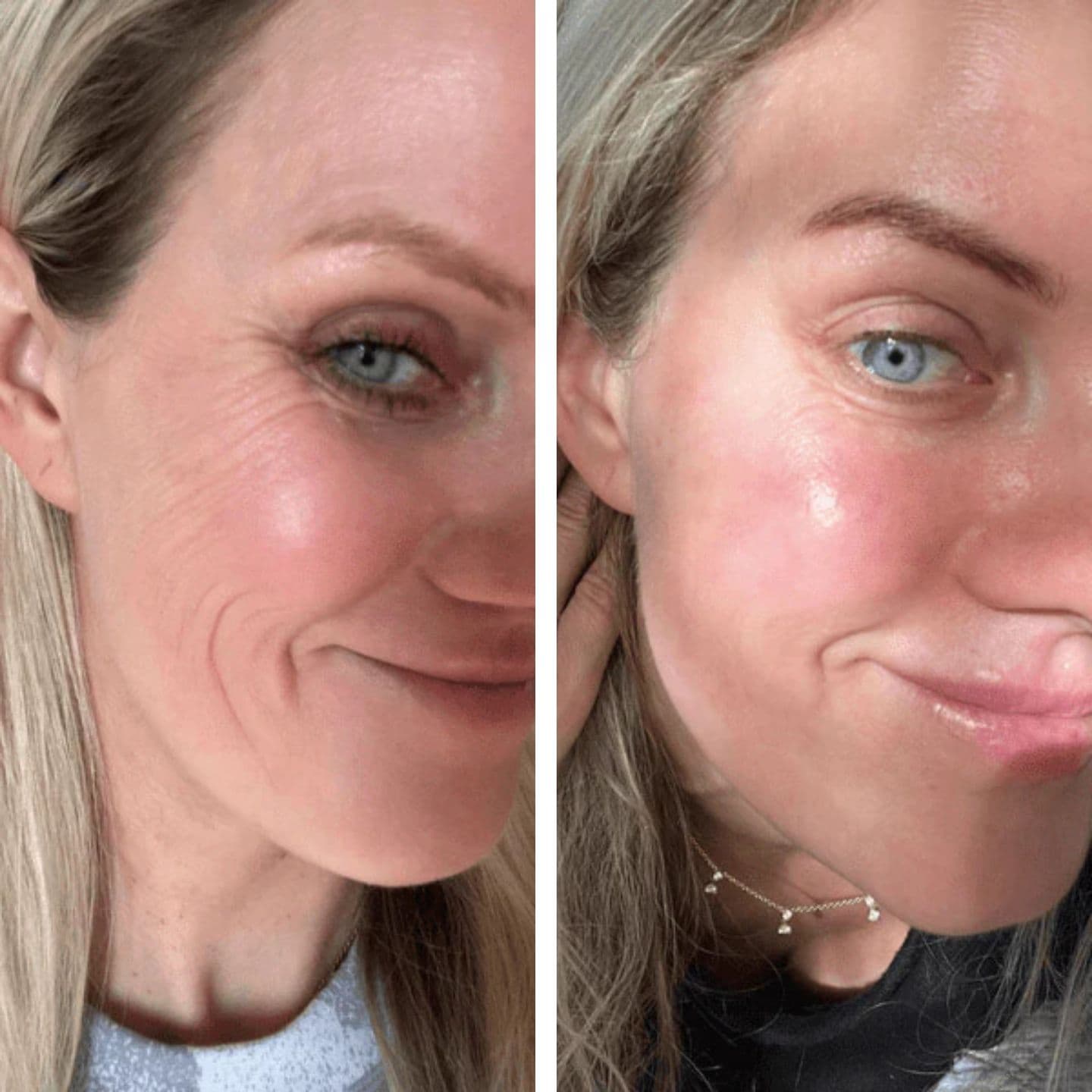 Αποτέλεσμα 1