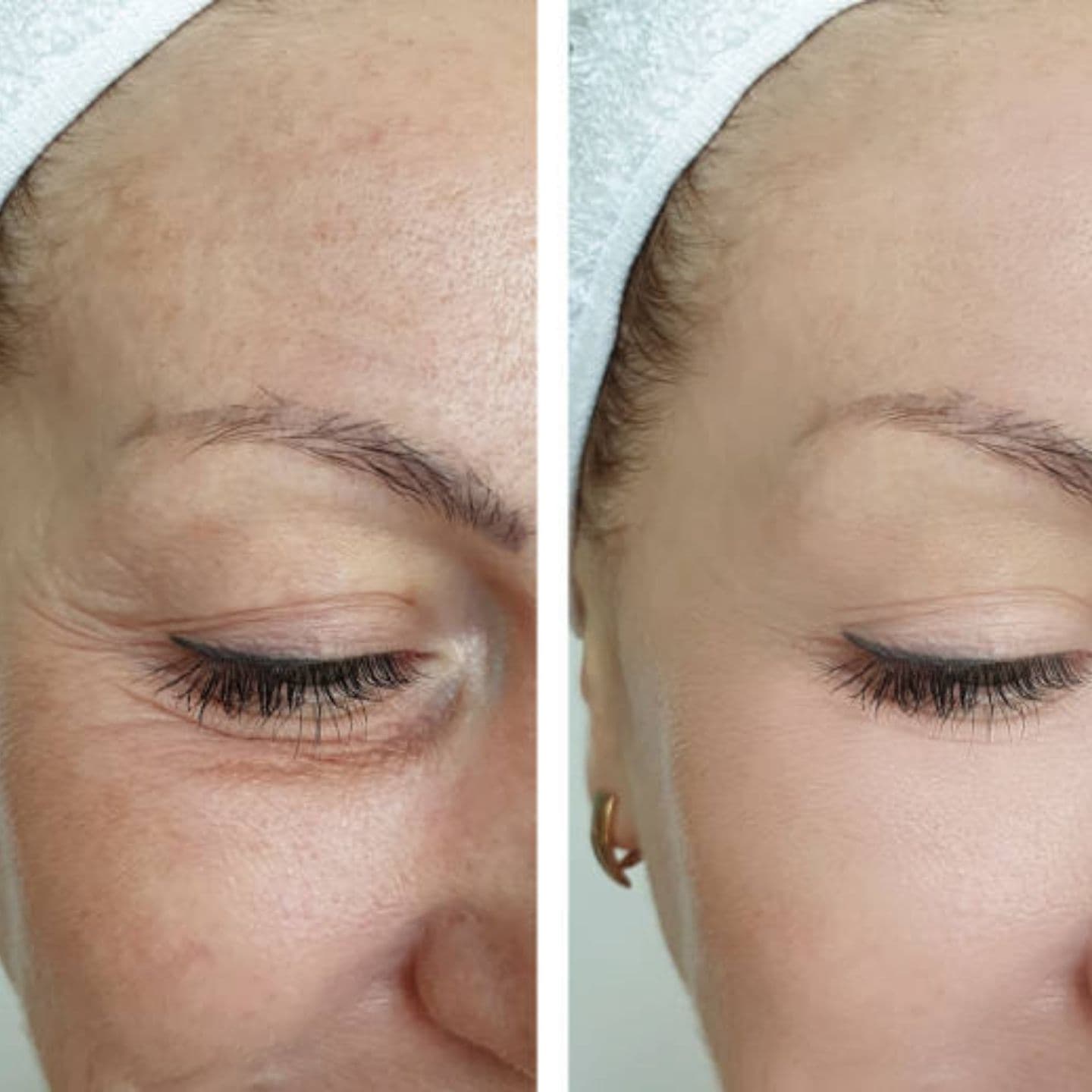 Αποτέλεσμα 2